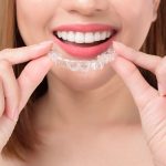 Telsiz Diş Tedavisi (invisalign) Nedir? Nasıl Yapılır?